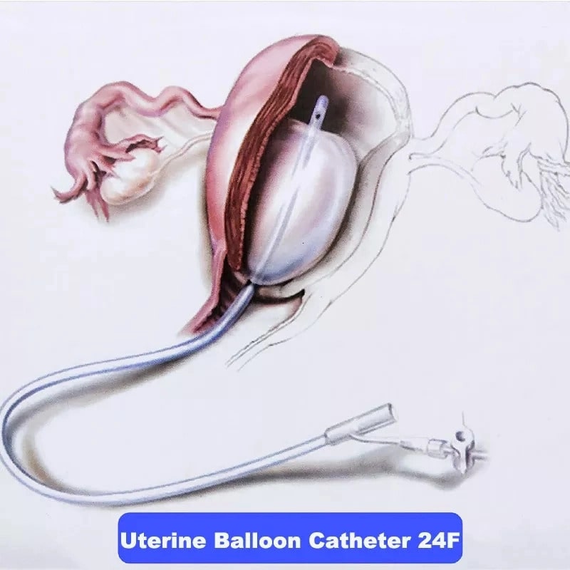 Silicone Postpartum Hemostatic Balloon (5).jpg